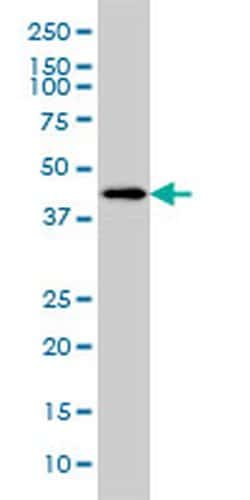 Invitrogen HSFX1 Monoclonal Antibody (1D7) 100 &mu;g; Unconjugated:Antibodies,
