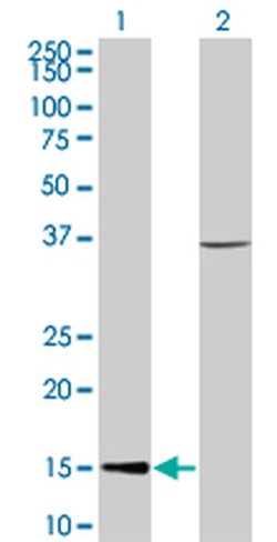 Invitrogen CHRAC1 Monoclonal Antibody (4B8) 100 &mu;g; Unconjugated:Antibodies,