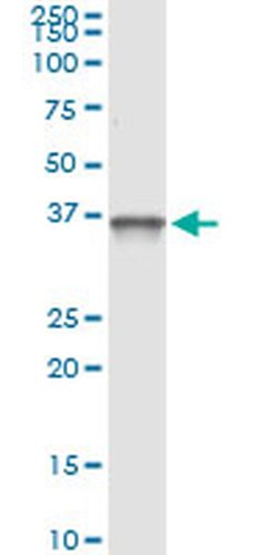 PIH1D1 Monoclonal Antibody (4F5-1E10) 100 &mu;g | Buy Online | Invitrogen | Fisher Scientific