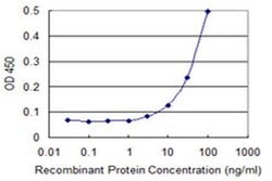 Invitrogen ZNF167 Monoclonal Antibody (3A12) 100 &mu;g; Unconjugated:Antibodies,
