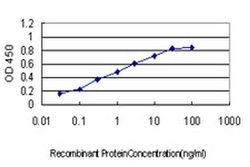 Invitrogen RNF20 Monoclonal Antibody (1C6) 100 &mu;g; Unconjugated:Antibodies,