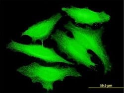 Invitrogen PAPOLB Monoclonal Antibody (3D7) 100 &mu;g; Unconjugated:Antibodies,