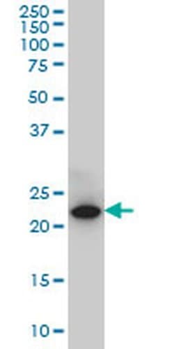 Invitrogen SPRYD7 Monoclonal Antibody (2G4) 100 &mu;g; Unconjugated:Antibodies,