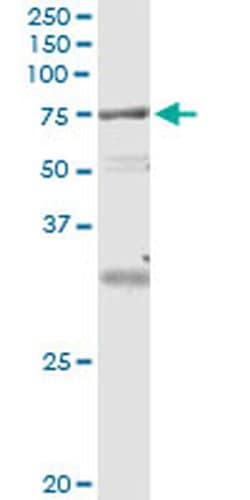 Invitrogen VPS18 Monoclonal Antibody (4E9) 100 &mu;g | Buy Online | Invitrogen&trade; | Fisher Scientific