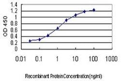 Invitrogen RBAK Monoclonal Antibody (6F9) 100 &mu;g | Buy Online | Invitrogen&trade; | Fisher Scientific