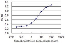 Invitrogen ZNF323 Monoclonal Antibody (4F7) 100 &mu;g; Unconjugated:Antibodies,