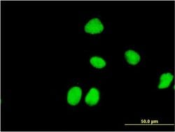 Invitrogen ZNF323 Monoclonal Antibody (4F7) 100 &mu;g; Unconjugated:Antibodies,