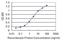 Invitrogen CENPH Monoclonal Antibody (1F7) 100 &mu;g; Unconjugated:Antibodies,