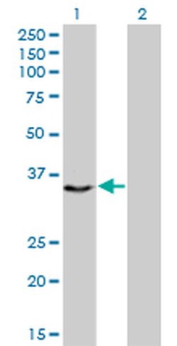 Invitrogen CENPH Monoclonal Antibody (1F7) 100 &mu;g; Unconjugated:Antibodies,