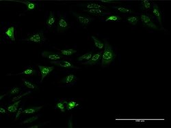 Invitrogen ZNF447 Monoclonal Antibody (2H1) 100 &mu;g; Unconjugated:Antibodies,