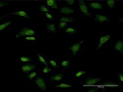 Invitrogen PRKRIP1 Monoclonal Antibody (4D11-3F11) 100 &mu;g; Unconjugated:Antibodies,