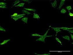 Invitrogen Gemin 7 Monoclonal Antibody (4H6) 100 &mu;g; Unconjugated:Antibodies,