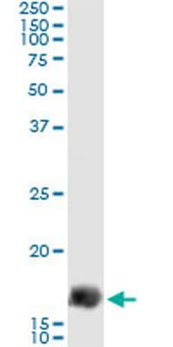 Invitrogen Gemin 7 Monoclonal Antibody (4H6) 100 &mu;g; Unconjugated:Antibodies,