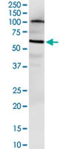 Invitrogen NUDT12 Monoclonal Antibody (3F7) 100 &mu;g; Unconjugated:Antibodies,