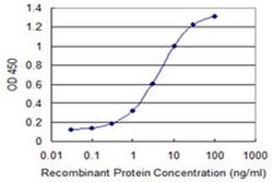 Invitrogen CaBP8 Monoclonal Antibody (2G2) 100 &mu;g; Unconjugated:Antibodies,