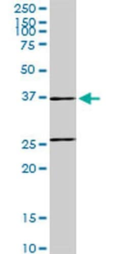 Invitrogen SNX29 Monoclonal Antibody (6D6) 100 &mu;g; Unconjugated:Antibodies,