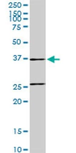 SNX29 Monoclonal Antibody (6D6), Invitrogen 100 &mu;g; Unconjugated:Antibodies,