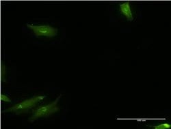 Invitrogen CaMKK alpha Monoclonal Antibody (4A11) 100 &mu;g; Unconjugated:Antibodies,
