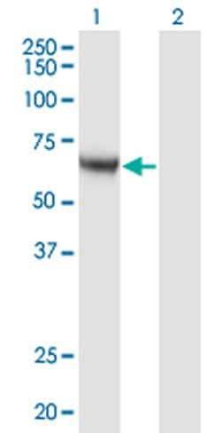 Invitrogen CaMKK alpha Monoclonal Antibody (4A11) 100 &mu;g; Unconjugated:Antibodies,