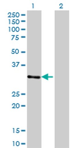 Invitrogen ZNF397 Monoclonal Antibody (1F8) 100 &mu;g; Unconjugated:Antibodies,