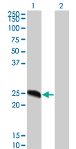 Invitrogen™ DYDC2 Monoclonal Antibody (8G4)