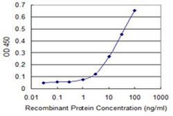 Invitrogen ZFYVE19 Monoclonal Antibody (3G4-2B11) 100 &mu;g; Unconjugated:Antibodies,