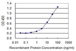 Invitrogen ZNF598 Monoclonal Antibody (1E2) 100 &mu;g; Unconjugated:Antibodies,