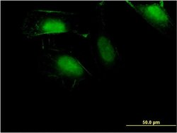 Invitrogen ZNF598 Monoclonal Antibody (1E2) 100 &mu;g; Unconjugated:Antibodies,