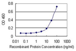 Invitrogen TRIM47 Monoclonal Antibody (3C8) 100 &mu;g; Unconjugated:Antibodies,