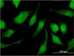 Invitrogen TRIM47 Monoclonal Antibody (3C8) 100 &mu;g; Unconjugated:Antibodies,