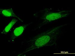 Invitrogen SNX20 Monoclonal Antibody (4E9) 100 &mu;g; Unconjugated:Antibodies,