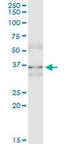 Invitrogen MSI2 Monoclonal Antibody (3B6) 100 &mu;g; Unconjugated:Antibodies,