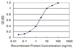 Invitrogen V-ATPase G3 Monoclonal Antibody (3A5) 100 &mu;g; Unconjugated:Antibodies,