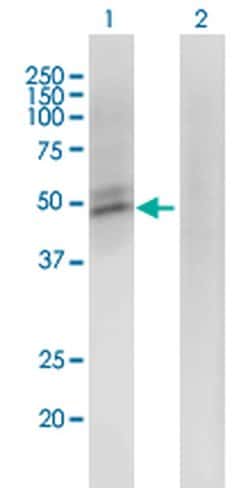 Invitrogen ACMSD Monoclonal Antibody (3A9) 100 &mu;g; Unconjugated:Antibodies,