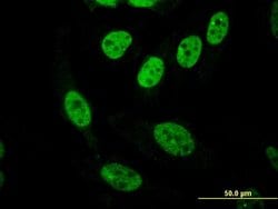 Invitrogen PASD1 Monoclonal Antibody (3C1) 100 &mu;g; Unconjugated:Antibodies,