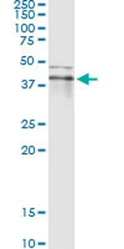 Invitrogen RNF113B Monoclonal Antibody (2B11) 100 &mu;g; Unconjugated:Antibodies,
