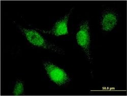Invitrogen SFRS12 Monoclonal Antibody (1D11) 100 &mu;g; Unconjugated:Antibodies,
