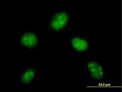 Invitrogen DYDC1 Monoclonal Antibody (1B11) 100 &mu;g; Unconjugated:Antibodies,