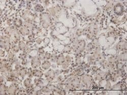 Invitrogen GSC Monoclonal Antibody (1C2) 100 &mu;g; Unconjugated:Antibodies,