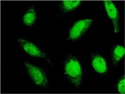 Invitrogen C18orf23 Monoclonal Antibody (3A1) 100 &mu;g; Unconjugated:Antibodies,