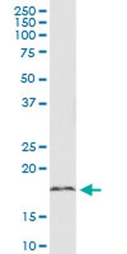 Invitrogen C18orf23 Monoclonal Antibody (3A1) 100 &mu;g; Unconjugated:Antibodies,