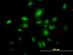 Invitrogen Septin-10 Monoclonal Antibody (2A12) 100 &mu;g; Unconjugated:Antibodies,