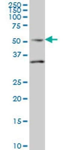 Invitrogen Septin-10 Monoclonal Antibody (2A12) 100 &mu;g; Unconjugated:Antibodies,