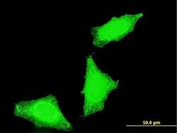Invitrogen PPP1R2P3 Monoclonal Antibody (1H2) 100 &mu;g; Unconjugated:Antibodies,