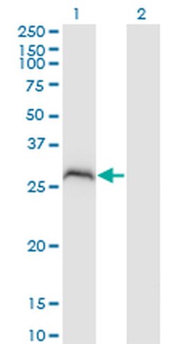 Invitrogen PPP1R2P3 Monoclonal Antibody (1H2) 100 &mu;g; Unconjugated:Antibodies,