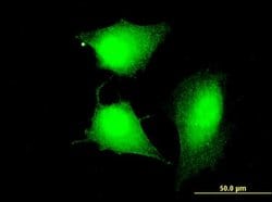 Invitrogen CCDC83 Monoclonal Antibody (3E3) 100 &mu;g; Unconjugated:Antibodies,