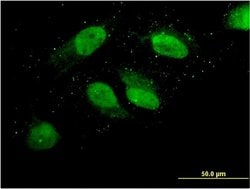 Invitrogen TL132 Monoclonal Antibody (3A2) 100 &mu;g; Unconjugated:Antibodies,