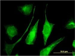 Invitrogen Adenylate Kinase 9 Monoclonal Antibody (1H8) 100 &mu;g; Unconjugated:Antibodies,