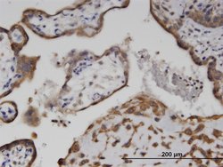 Invitrogen Adenylate Kinase 9 Monoclonal Antibody (1H8) 100 &mu;g; Unconjugated:Antibodies,