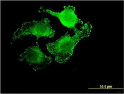 Invitrogen UNC5CL Monoclonal Antibody (3G7) 100 &mu;g; Unconjugated:Antibodies,